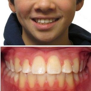 After Kids Dentistry