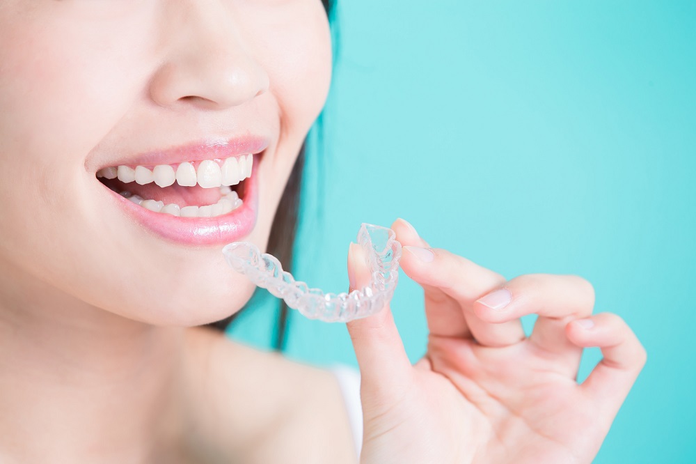 Clear Aligners