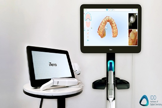 Itero Scanner