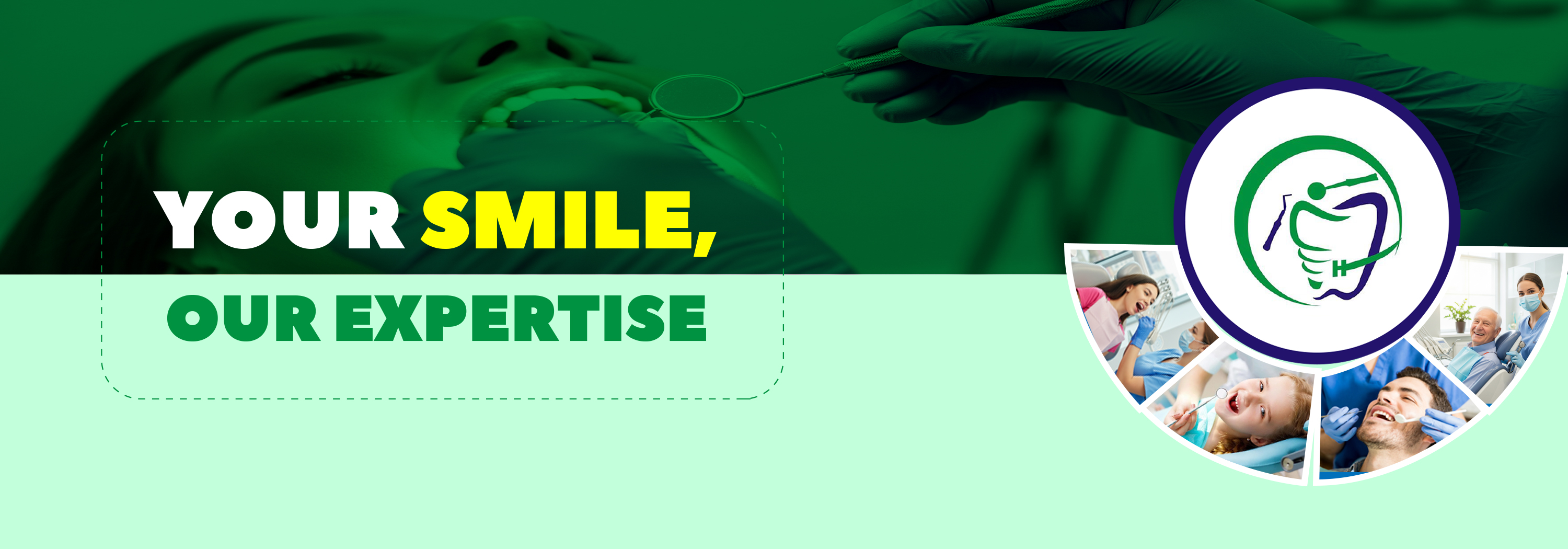 Aligner offer from Clove Dental: Save ₹1,00,000.