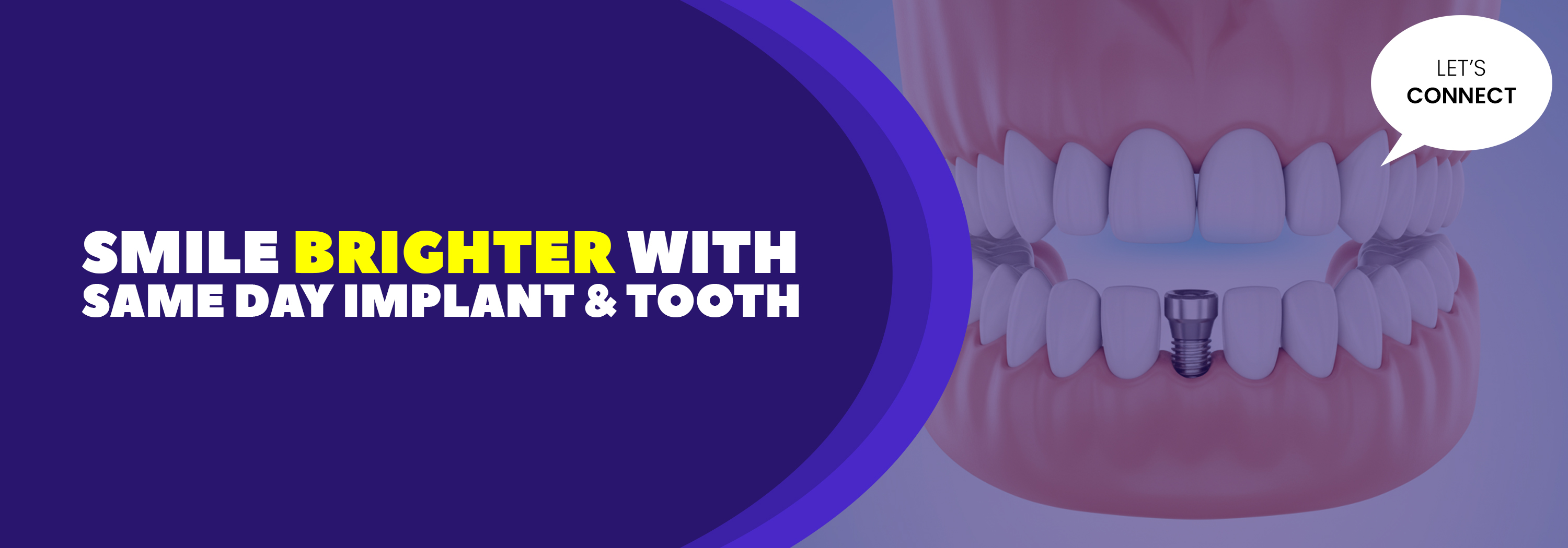 Best Dental Chain in India | Over 600+ Dental Clinics